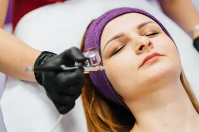 SilkTouch laserowe zabiegi kosmetyczne